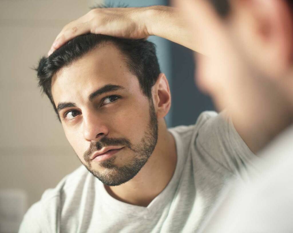 man-hairloss