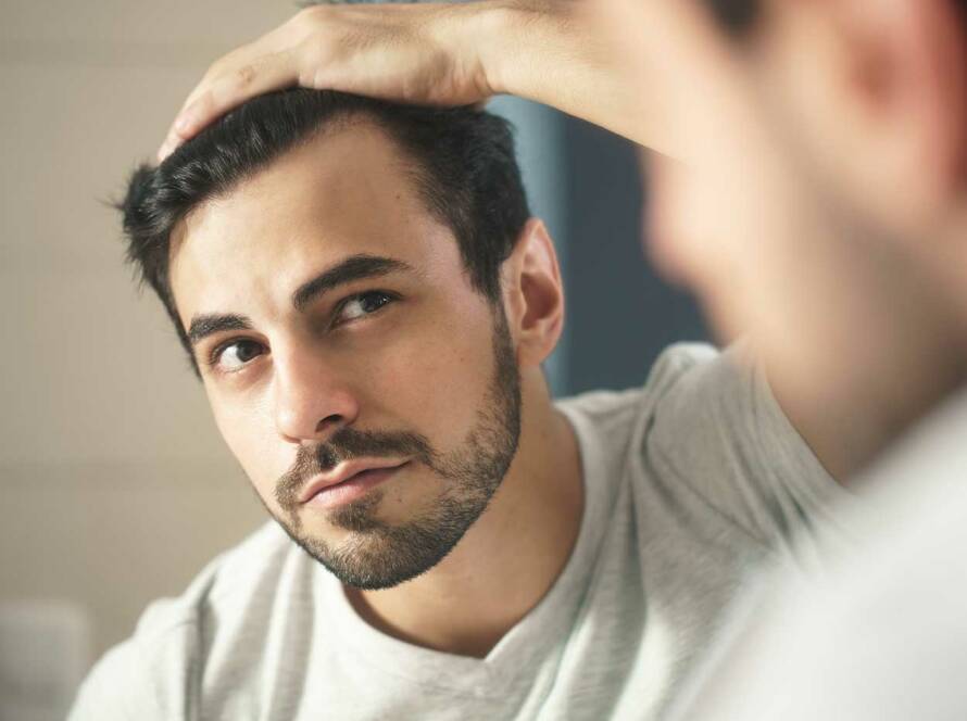 man-hairloss