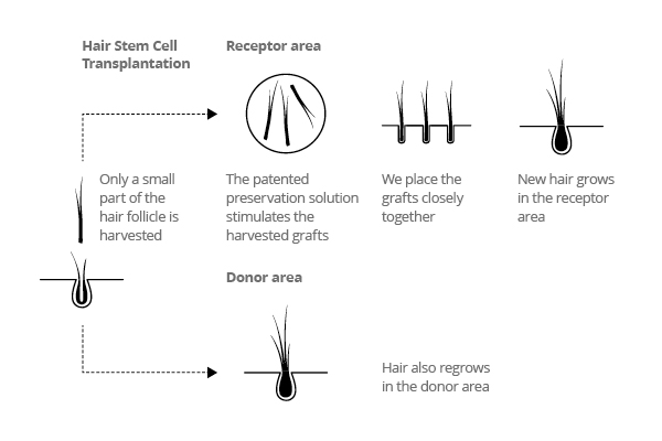 HST transplant method HST